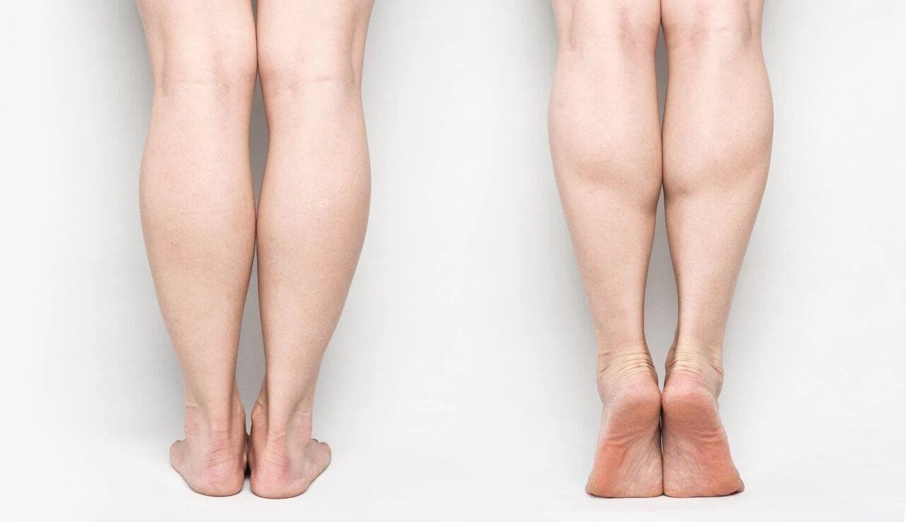 最新研究：踮脚成新型保健热潮